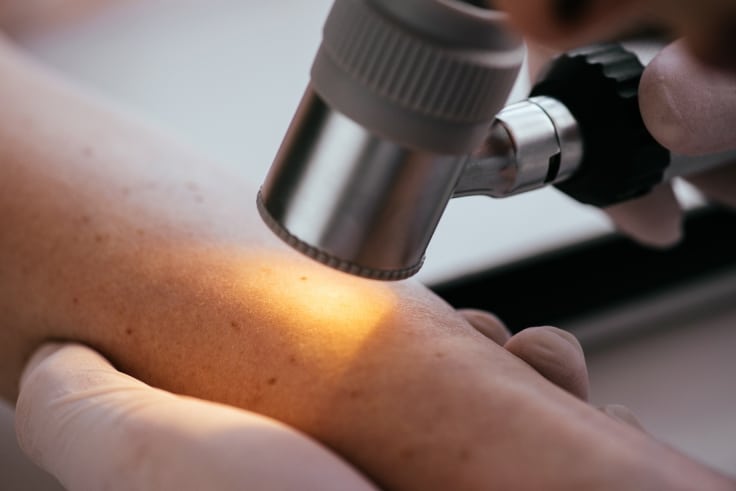 Prioritize Your Skin's Future: Book a Lesion Assessment Today!